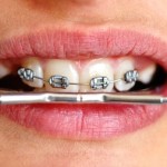 orthodontie
